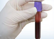 Гематологія Гематологія