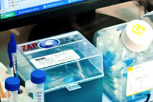 Боковий аміотрофічний склероз і стовбурові клітини