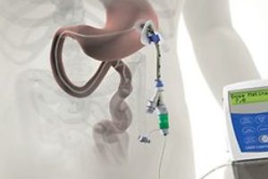 Хвороба Паркінсона тепер можна лікувати новим способом