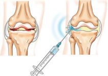 Ревматологія