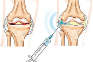 Ревматологія