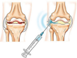 Ревматологія