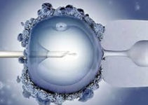 Курс ЕКЗ в Ізраїлі: останні новини про процедуру