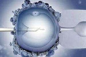 Курс ЕКЗ в Ізраїлі: останні новини про процедуру