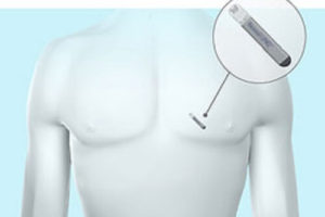 Мініатюрні кардіомонітори малюкам