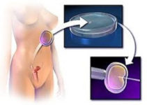 Найкращі клініки ЕКЗ в Ізраїлі