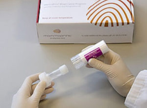 Нові тести в онкології