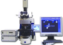 Новий метод ранньої діагностики раку легенів Новий метод ранньої діагностики раку легенів