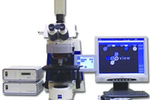 Новий метод ранньої діагностики раку легенів