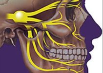 Переважний метод лікування невралгії трійчастого нерва