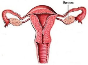 Превентивне видалення яєчників - думка фахівців