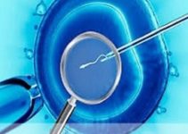 Процедура ЕКЗ за методикою ІМСІ — кінець чоловічого безпліддя