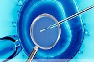 Процедура ЕКЗ за методикою ІМСІ — кінець чоловічого безпліддя