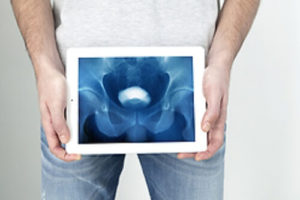 Процес лікування раку простати першій стадії не впливає на смертність пацієнта