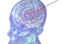 Променева терапія стала безпечніше Променева терапія стала безпечніше