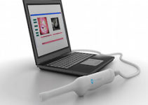 Сучасна технологія діагностики раку шийки матки Сучасна технологія діагностики раку шийки матки