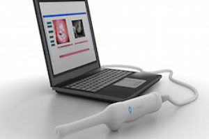 Сучасна технологія діагностики раку шийки матки